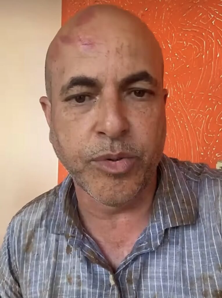 Screenshot_20260413_180305_Instagram-764x1024 SUSTO GRANDE - Deputado Ismael Crispim sofre acidente na BR-429